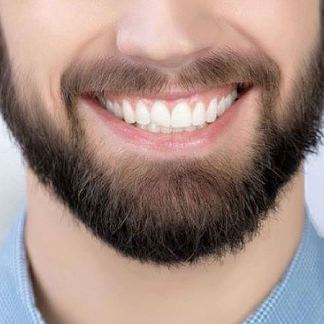 Bart und Schnurrbart Transplantation